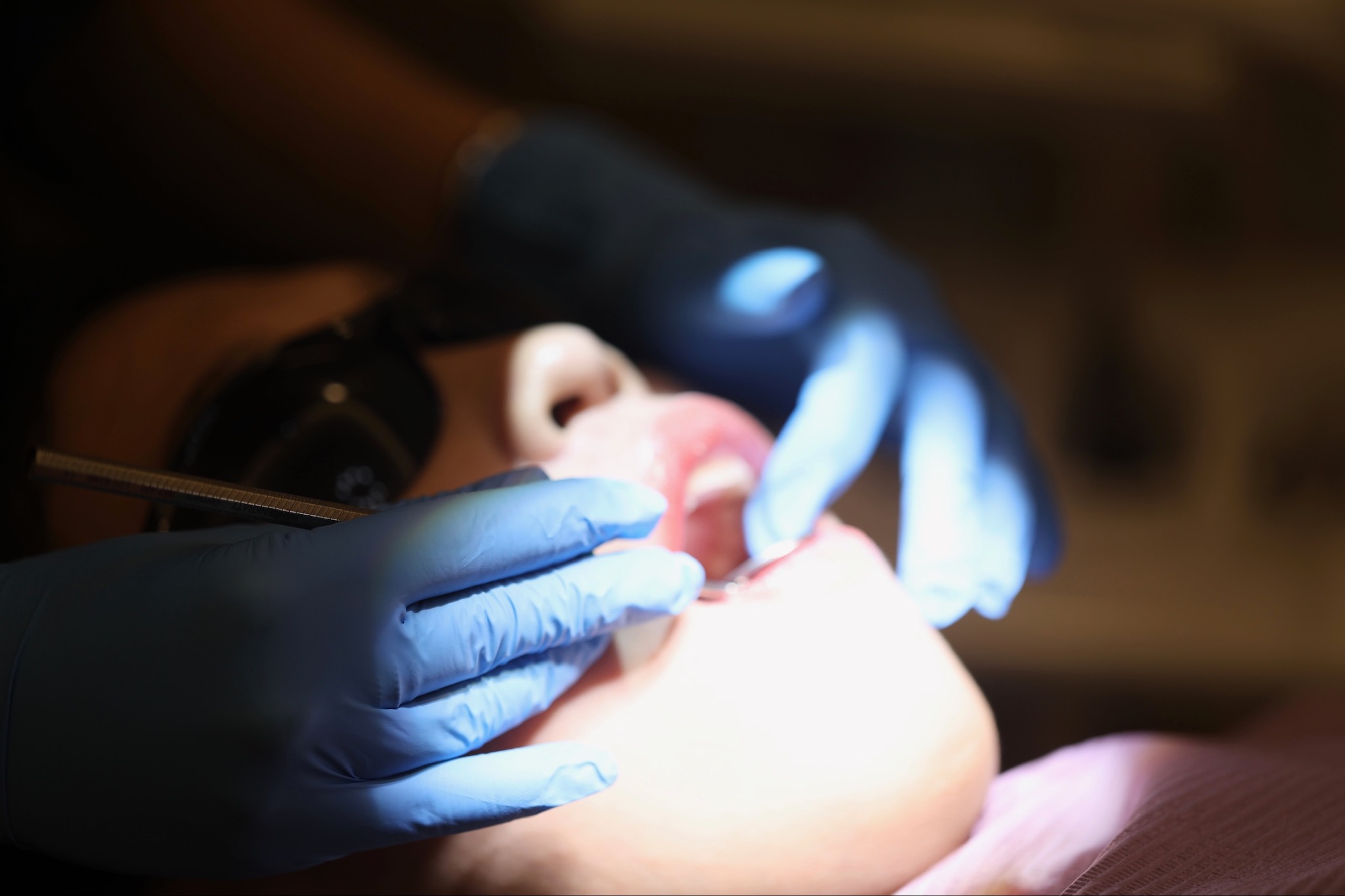 Clinical Dental Examination